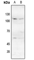GRIN1 (Phospho-S896) antibody