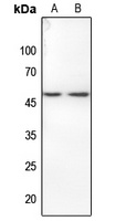 HDAC3 (Phospho-S424) antibody