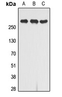 Anti-CD222 Antibody