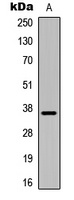 Anti-IGFBP1 Antibody