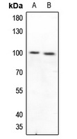 Anti-CD210a Antibody