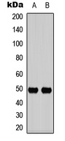 IL13RA1 (Phospho-Y405) antibody