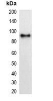 mCherry-tag antibody