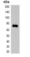 mCherry-tag antibody