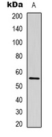Anti-Beta-tubulin Antibody