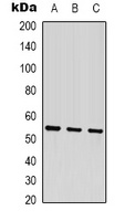 Anti-Beta-tubulin Antibody