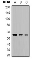 Anti-Beta-tubulin Antibody