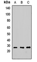 Anti-FGF2 Antibody
