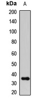 IGFBP2 antibody