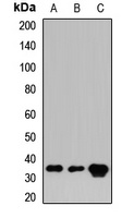 Anti-CRKL Antibody