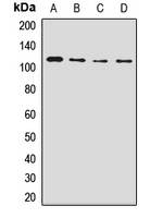 Anti-NUP98 Antibody