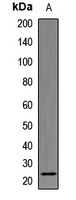 Anti-RALA Antibody