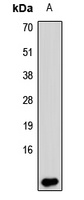 S100B antibody