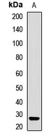 Anti-SMNDC1 Antibody