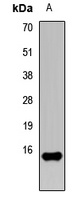 Anti-FABP5 Antibody