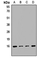 Anti-PPP3R1 Antibody