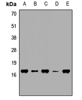 Anti-VILIP-3 Antibody