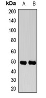 Anti-NGRH2 Antibody