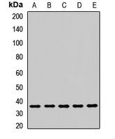Anti-LRRC59 Antibody