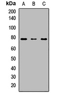 Anti-UGT1A6 Antibody