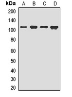 Anti-CD167b Antibody