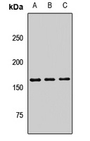 PLA2R1 antibody