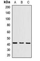 Anti-HLA-C Antibody