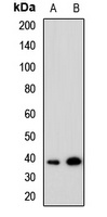 Anti-TRIB1 Antibody