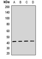 Anti-TSLPR Antibody