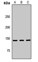 Anti-IleRS Antibody