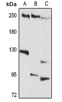 Anti-Envoplakin Antibody