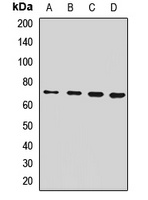 Anti-SLC11A2 Antibody