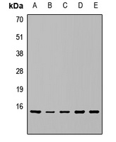 Anti-RPS15A Antibody