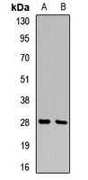 Anti-14-3-3 sigma Antibody