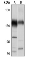 CACNA2D2 antibody