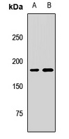 Anti-KIF14 Antibody