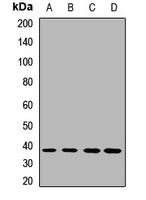 Anti-DDAH1 Antibody