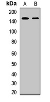 Anti-LRIG1 Antibody