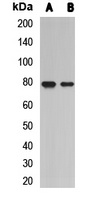 L3MBTL2 antibody