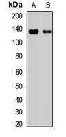 DIAPH3 antibody