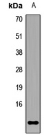 KIAA0101 antibody