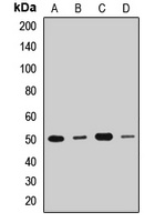 Anti-DDX47 Antibody