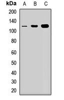 NOP14 antibody