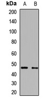 Anti-AADAC Antibody