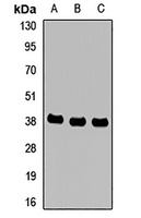 Anti-MTHFD2 Antibody