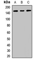 RBM6 antibody