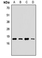 Anti-UBE2G2 Antibody