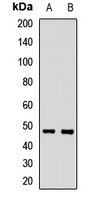 SLC39A14 antibody