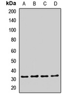 Anti-EXOSC2 Antibody