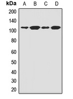 FCRL3 antibody